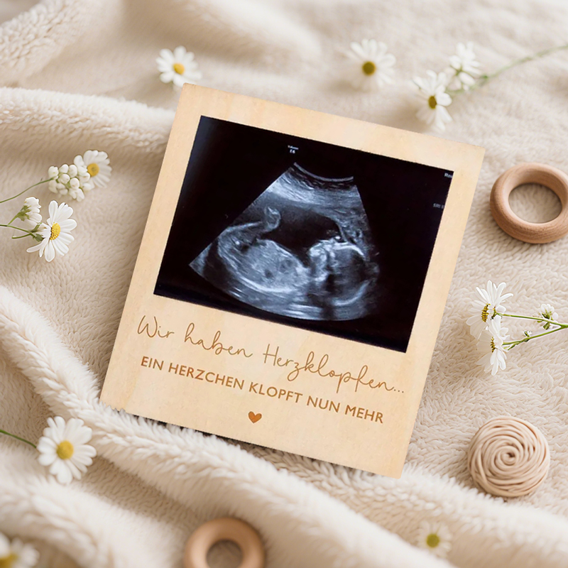 Echografie Zwangerschap Aankon - Baby Nursery Images recensie en prijs
