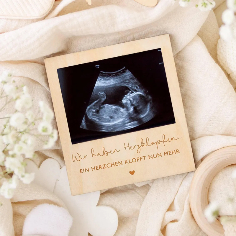 Echografie Zwangerschap Aankon - Baby Nursery Images recensie en prijs